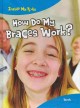 Go to record How do my braces work?